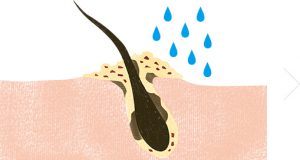 毛根についている皮脂汚れのイメージ