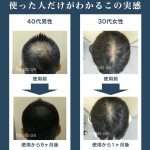イクモプレミアムの使用前使用後