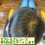 イクモプレミアムコース1スタート頭頂部
