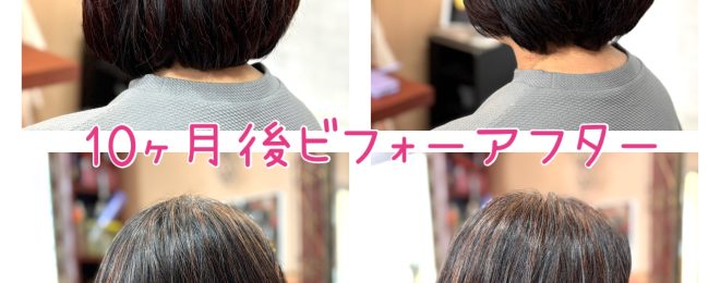 10ヶ月後ビフォーアフター